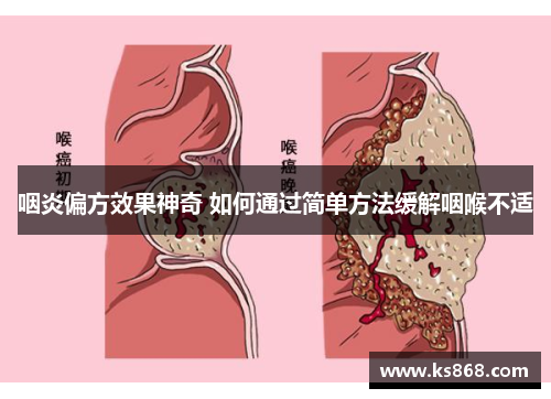 咽炎偏方效果神奇 如何通过简单方法缓解咽喉不适